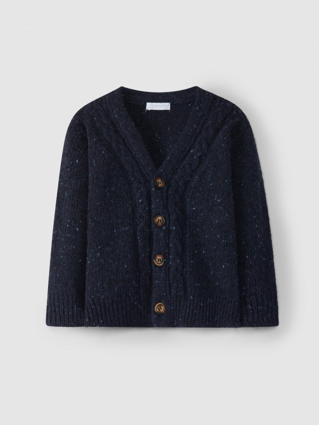 Gilet tricoté avec détail de tresse Gilet tricoté avec détail de tresse