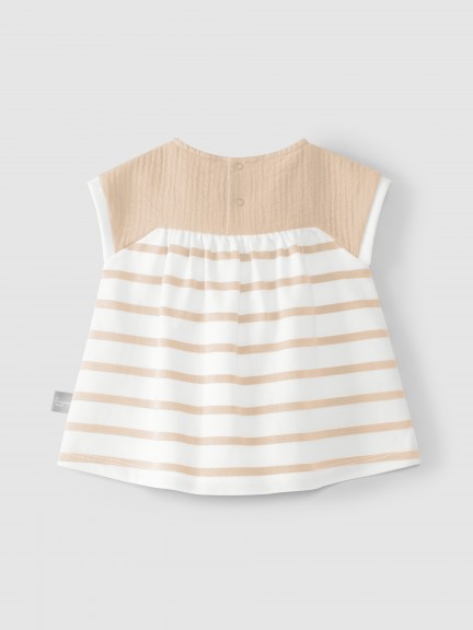 Striped dress Striped dress