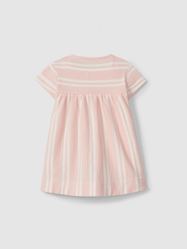 Striped dress Striped dress