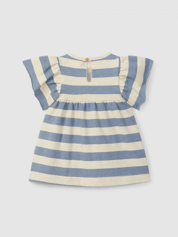 Striped dress Striped dress